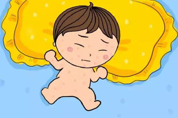 小儿湿疹如何预防?家长做好这几点