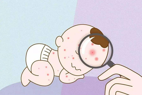 儿童皮肤病有哪些类型